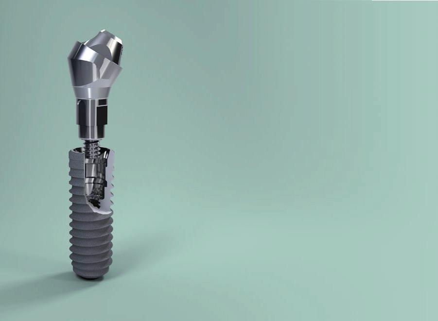 An excellent combination of scientifically proven implants and sleek prosthetic components The new Straumann Screw-retained Abutment provides a wide range of prosthetic options for screw-retained