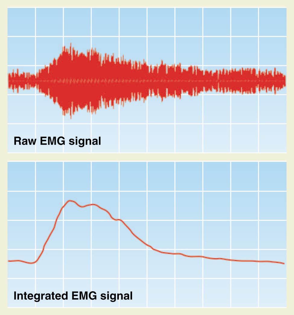 Measures of Somatic Nervous System Activity Electromyogram (EMG)