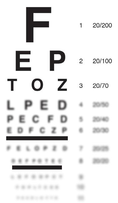Your Vision How your visual acuity may be impacted Visual acuity is the sharpness of vision. It is measured by the ability to read letters on an eye chart.
