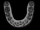 from minor tooth movements to more complex cases.