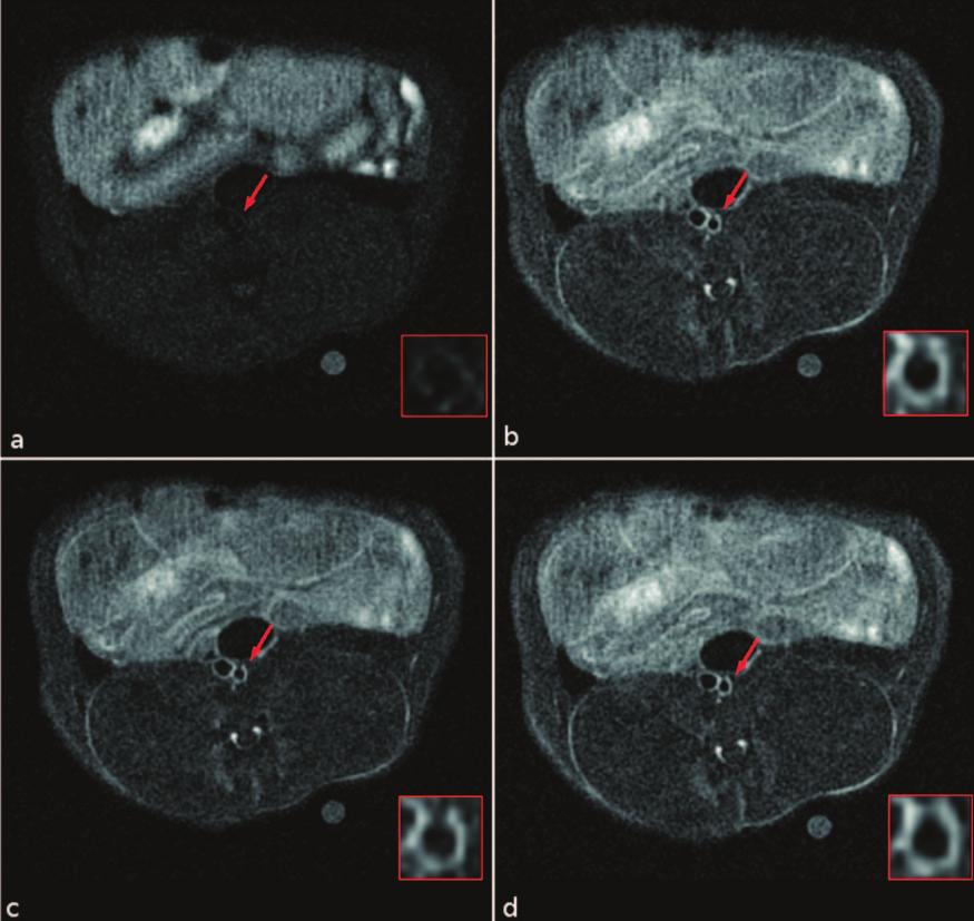 Calcagno et al Detection of Neovessels in Atherosclerosis by MRI and PET 1313 Figure 2.