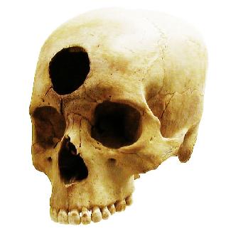 OpenStax-CNX module: m55665 2 Figure 1: Some of our ancestors, across the world and over the centuries, believed that trephination the practice of making a hole in the skull, as shown hereallowed
