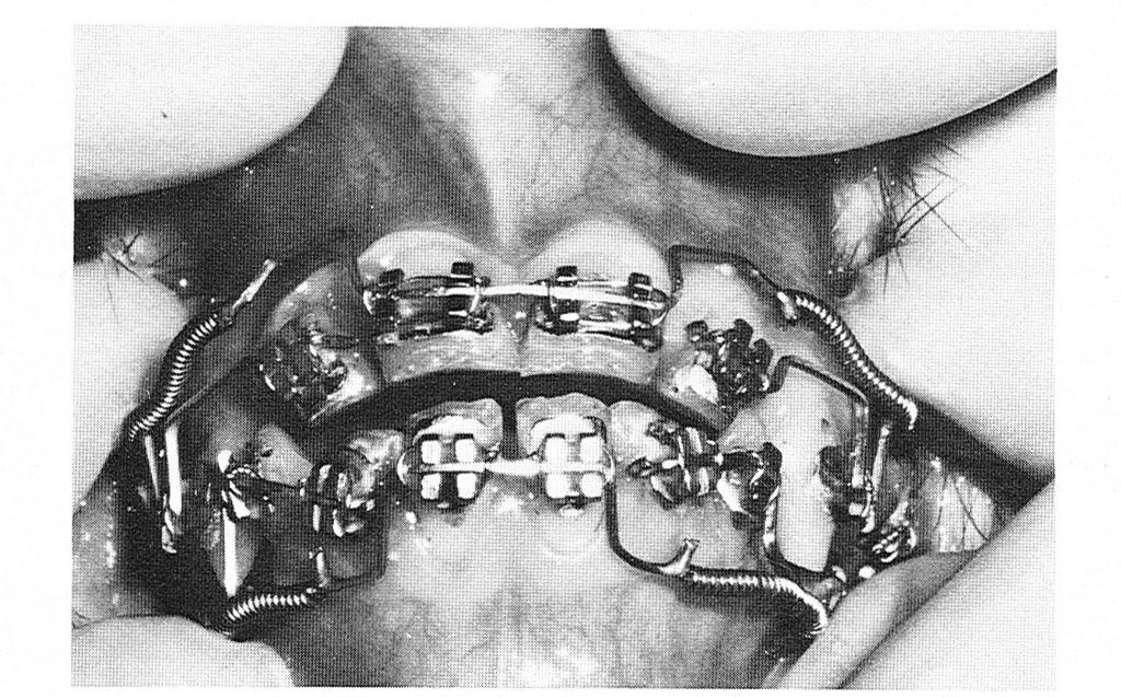 Animals, maxilla/ mandible, mechanical cleaning/chlorhexidine, surgery/ nonsurgery, served as design variables.