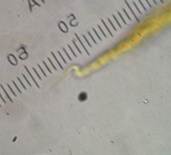 Larva of Strongyloides