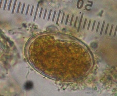 Egg of Strongyloides sp.