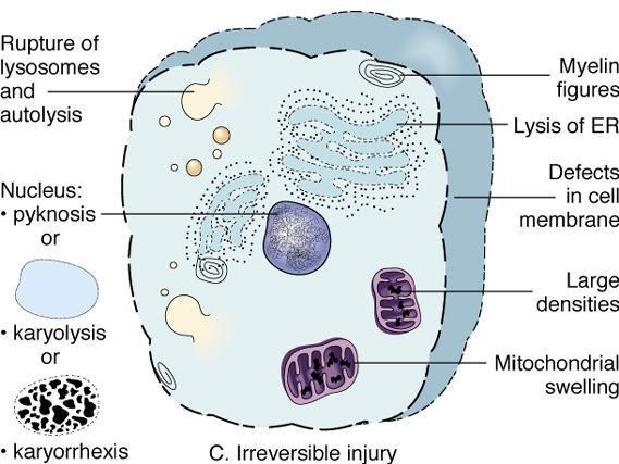 Myelin figures: Myelin figures: aggregates of damaged cell membranes (phospholipids), it attracts calcium it is seen as a morphologic change in reversible and irreversible cell injury.