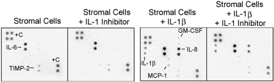 BM Stromal cells support MM cells by secretion of IL-6 in response to MM produced VEGF, IL1 β, and TNF.