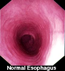 Esophagus Muscular, connects mouth to stomach Lined