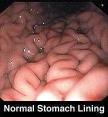 c. Stomach = j-shaped, muscular pouch i.