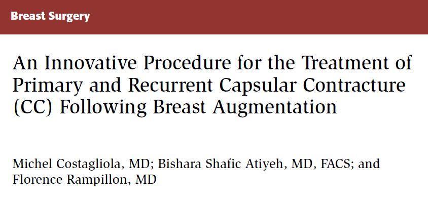 Steroid Irrigation 33 patients with established CC Capsulectomy & catheter irrigation x