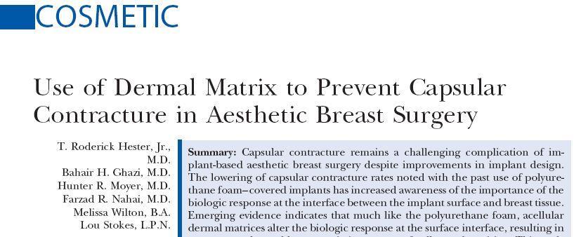 ADM: Strattice 70 breasts with CC & 1.