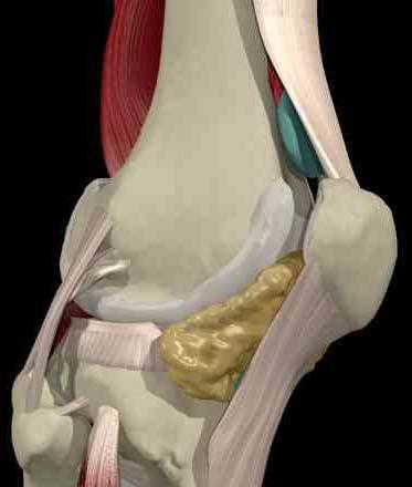 Medial lateral stability Cruciate ligaments A P