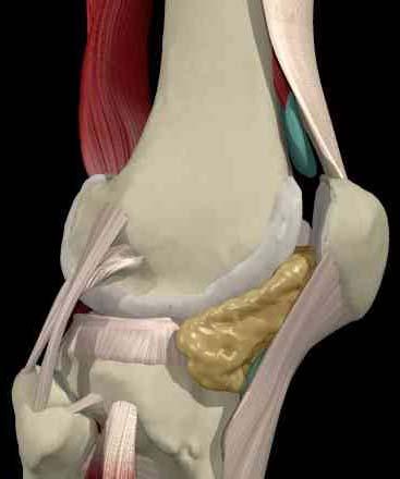 Function of the patellofemoral joint Reduces friction between the quadriceps