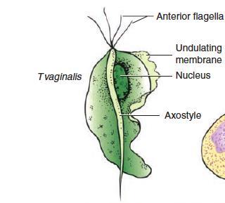 TRICHOMONAS (Urogenital flagellated protozoa) Trichomonads are flagellated protozoa with 3-5 anterior flagella.