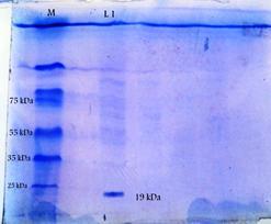 SDS PAGE Protein pattern of effective Acalypha indica leaf: TABLE 7: RESULTS OF PHYTOCHEMICAL TESTS S. NO.