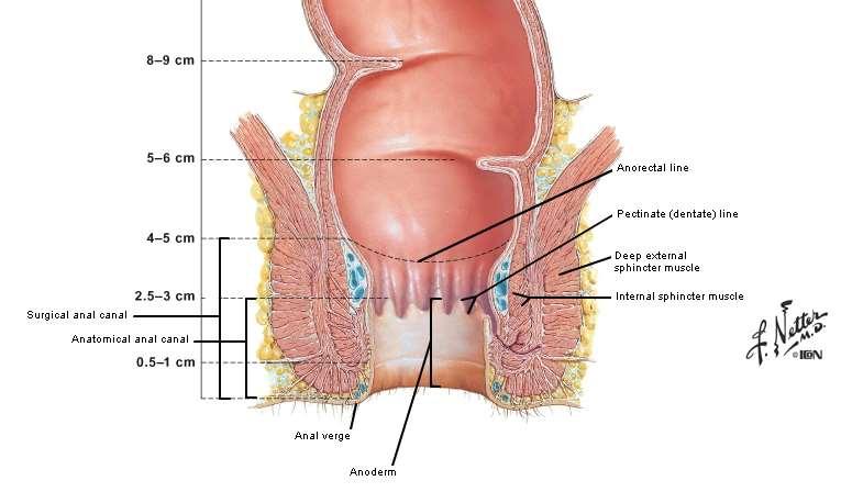 Cervix and Anus: Lesions morphologically similar Low grade High grade Netter Presenter Image