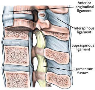 Ligaments: Lumbar Spine Lateral View