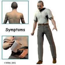 History of Symptoms Red Flags Gait and Clumsiness Symptom/Exam I