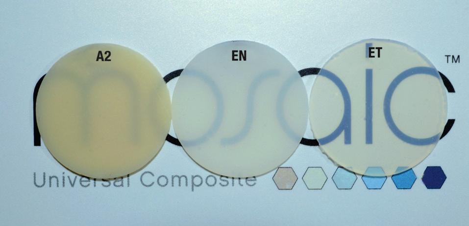 OPACITY AND TRANSLUCENCY Composite materials that have a wide range of shades and opacities allow for duplication of adjacent tooth structure, which contributes to success for even the most diverse