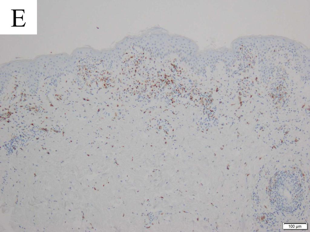 (Continued) (D) A small number of neutrophils are stained