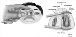 Nasal Anatomy Anterior