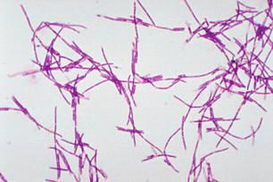 The Organism Bacillus anthracis Large, gram positive non-motile rod
