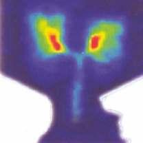 Immediately after inhaling the radiolabelled aerosol, the subject had the imaging performed, using a gamma camera.