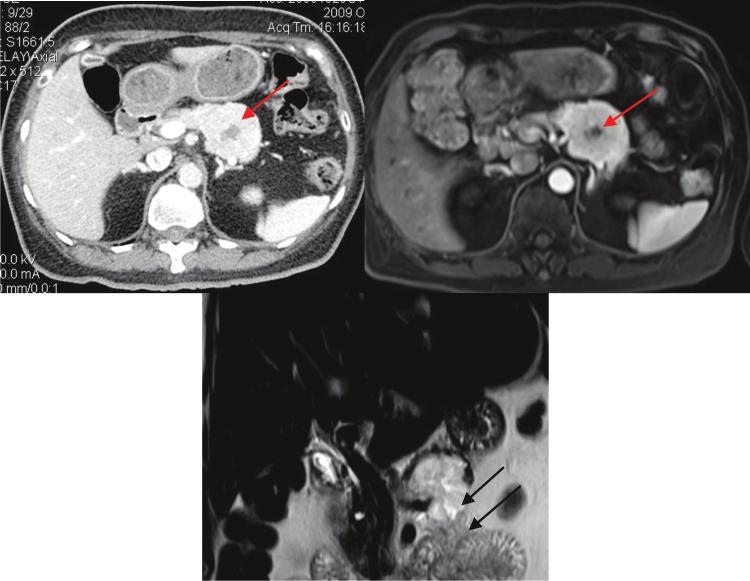 X-ray Corner 125 Imaging of The Pancreas Modern imaging modalities commonly used in pancreas include ultrasound (US), CT, and MRI.