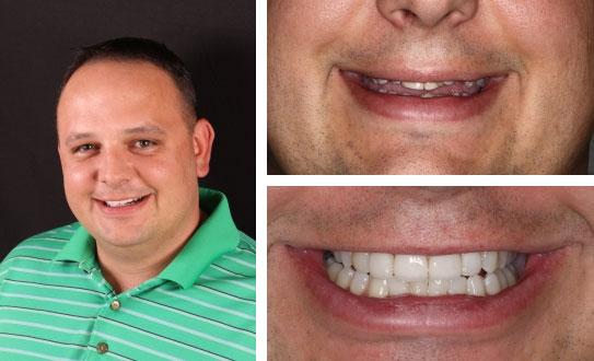 Neuromuscular Orthodontics As an experienced and extensively trained neuromuscular dentist, Dr.