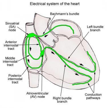 Cardiac Conduction: SVT =