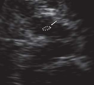 Transcranial ultrasound Li et al: Overall