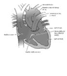 Single Ventricle Anatomy