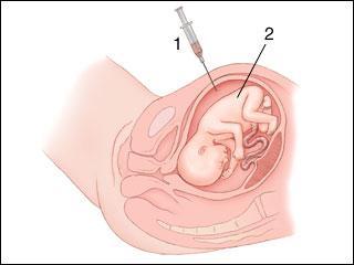 developing baby, or FETUS.