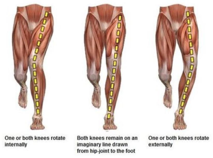 Knee Pain Specifically Patella Femoral Pain Syndrome (PFPS) The most common complain of knee pain comes from squatting or lunging.