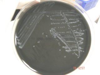 CAMPYLOBACTER SELECTIVE AGAR Diagnostics Campy CVA Agar contains peptamin which provides carbon, sulfur, and nitrogenous compounds required for growth.