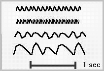an electrochemical organ Post-synaptic potentials arise in neurotransmission; voltage gradients give rise to current flows, which generates a magnetic field as well as a voltage waveform at the scalp