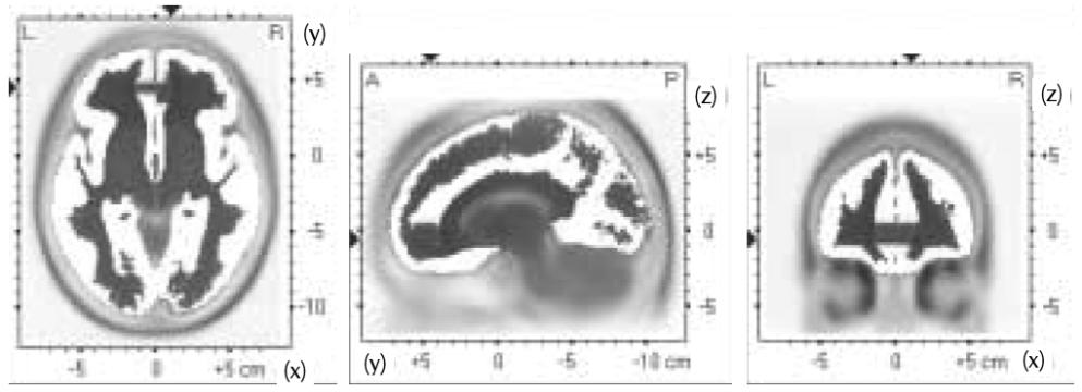 Theta activity in the rostral-most anterior cingulate (Brodman