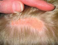 Case 3 Mommy, what s wrong with my head? A five-year-old male presents with an orange plaque on his scalp. There is no hair growth within this plaque. What do you suspect? a. Aplasia cutis b.