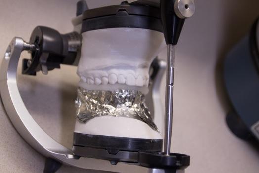 INDEX OCCLUSAL SURFACES place lower cast with acrylic back into articulator - be sure horizontal elements are locked slowly close upper over acrylic until