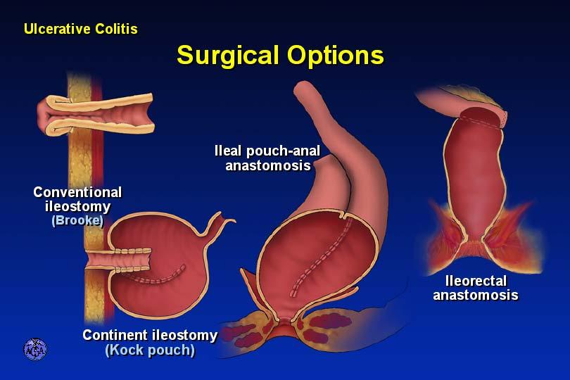 SURGICAL OPTIONS