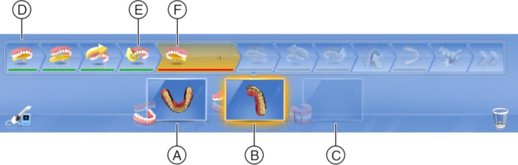 Scan Objects and Sequence Bars The guided scanning process contains 3 scan objects: Lower jaw scan (A) Upper jaw scan (B) Buccal registration (C) The selected scan object is highlighted in yellow (B).