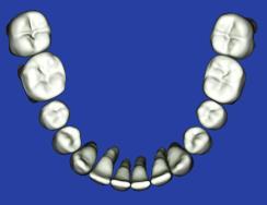 Capture Scan Pieces Although the CEREC software is designed for full arch scanning, you can