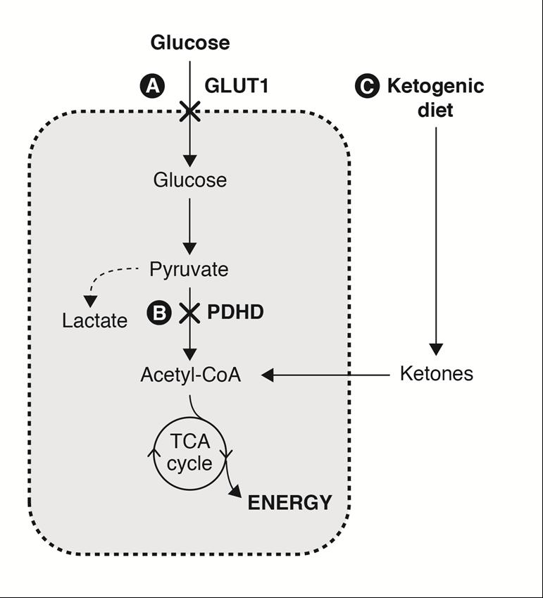 Use in PDHD Pyruvate dehydrogenase deficiency A ketogenic diet 1.