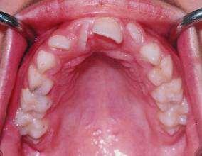 teeth are grouped into anterior (incisor) and posterior (molar) segments.