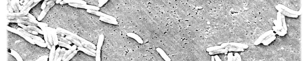 Staphylococcus aureus, Bacillus cereus, or Escherichia coli (E.