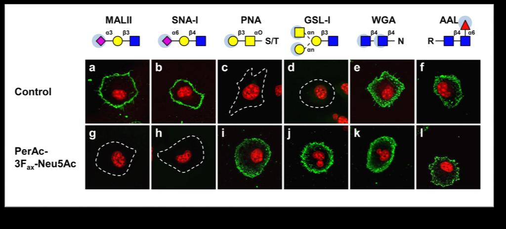 Inhibition of sialylation slows tumor growth and metastasis Cell culture with 64mM concentration of inhibitor leads to almost complete desialylation Cell