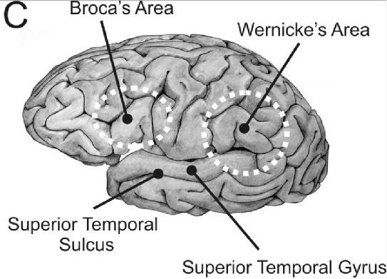 Wernicke s Area Wernicke s aphasias are often associated with lesions at the