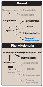 Characteristics of classic PKU: Elevated phenylalanine in tissues, plasma, and urine.