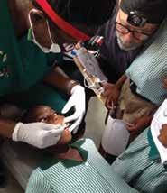 In the end, we also observed a 100 percent reduction in pain as well as roughly 90 percent success at caries arrest as anticipated (Figs.