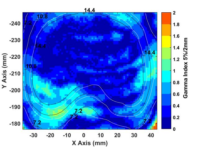 PART III: 2D Gamma Index comparison For indicative axial slices of the irradiated phantom, 2D isodose